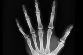 black-and-white-bones-hand-207496