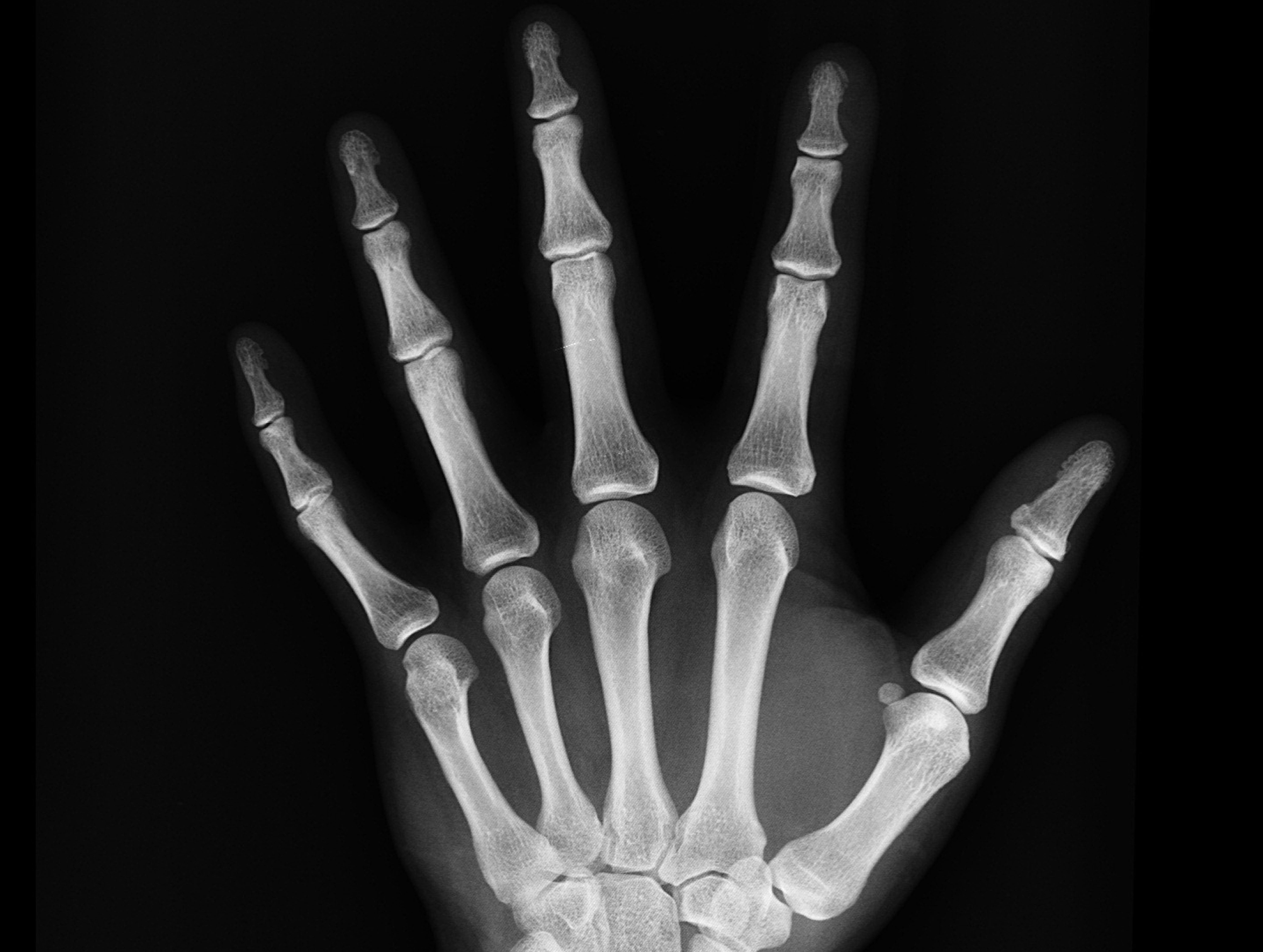 black-and-white-bones-hand-207496